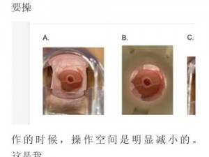 内检的时候医生手剥了一圈，帮助你快速顺产的助产神器