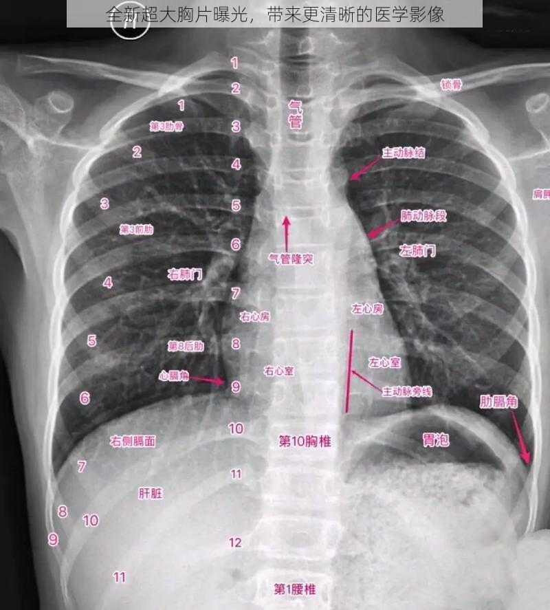 全新超大胸片曝光，带来更清晰的医学影像