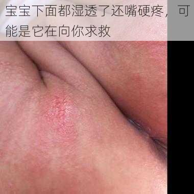 宝宝下面都湿透了还嘴硬疼，可能是它在向你求救