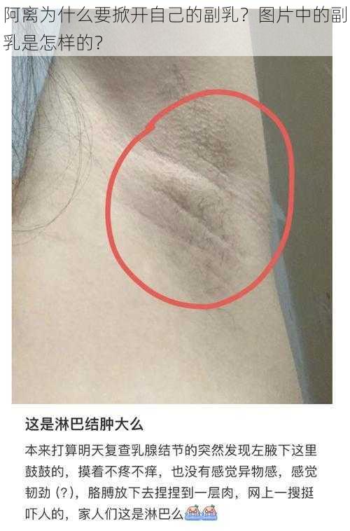 阿离为什么要掀开自己的副乳？图片中的副乳是怎样的？