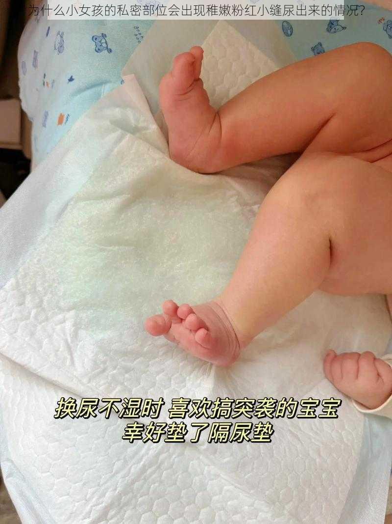 为什么小女孩的私密部位会出现稚嫩粉红小缝尿出来的情况?