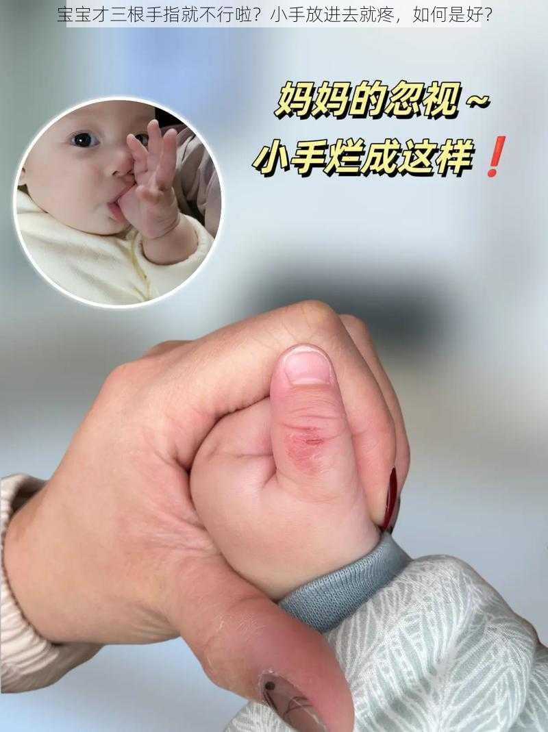 宝宝才三根手指就不行啦？小手放进去就疼，如何是好？